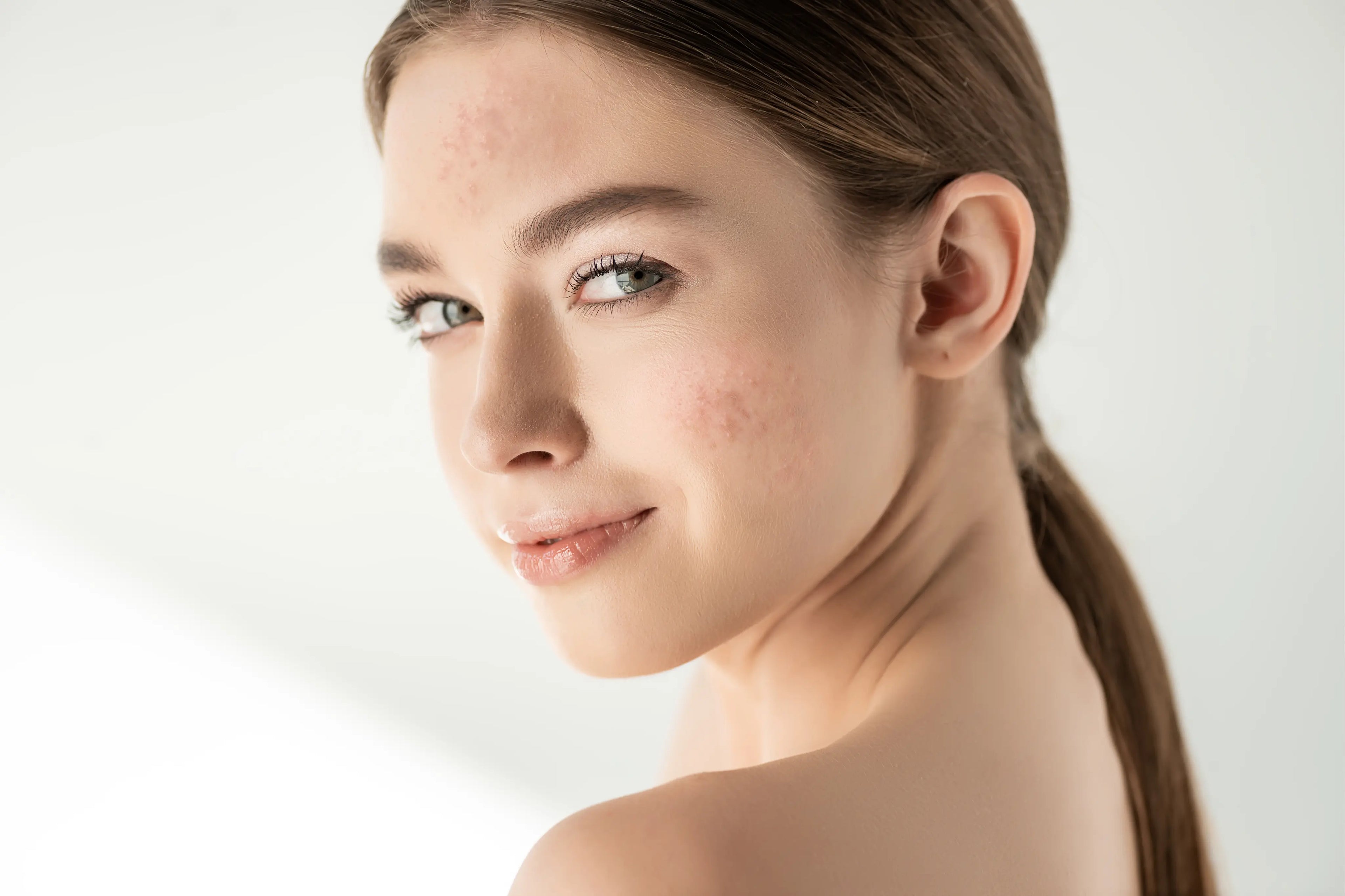 woman with freckles