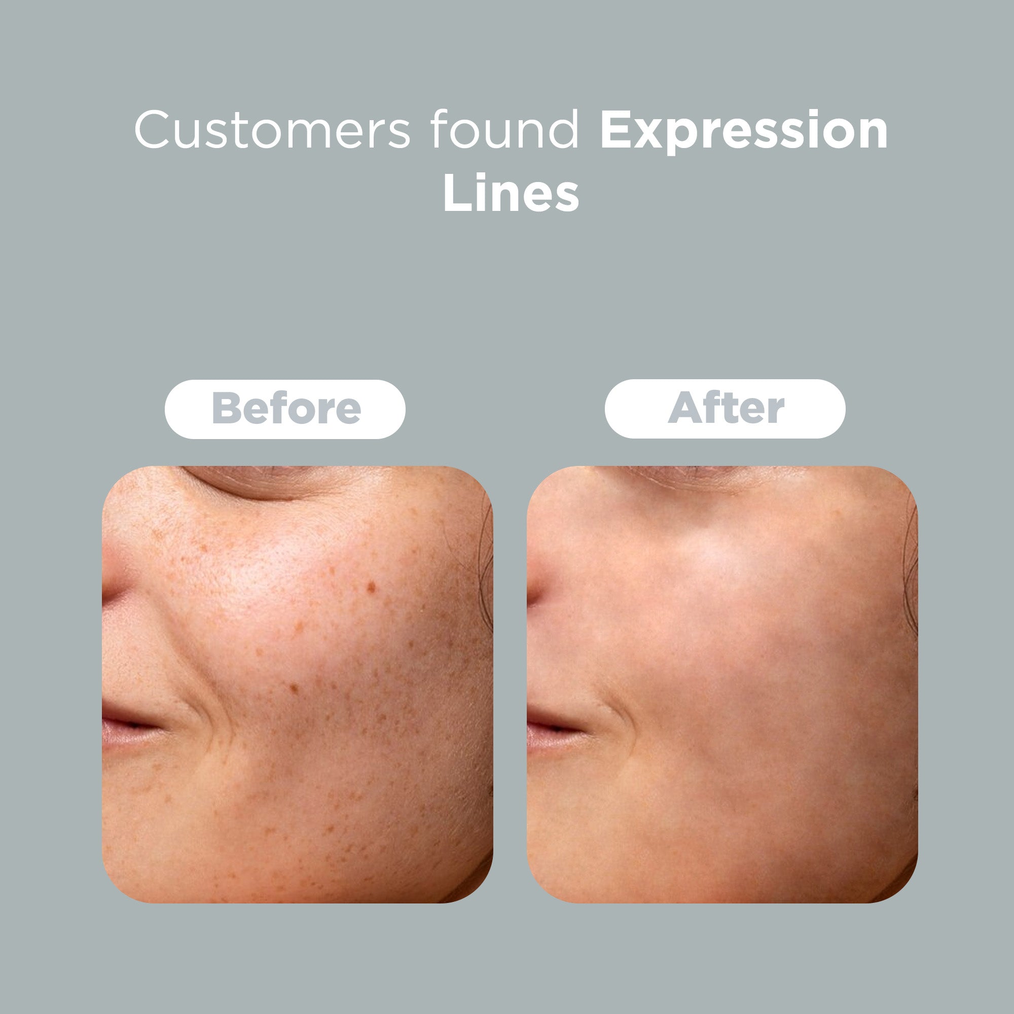 Cica Cream – terrafique